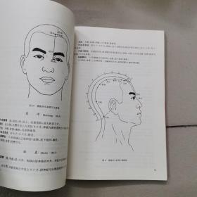 标准针灸穴位图册