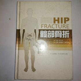髋部骨折
