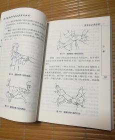 刘寿山正骨经验