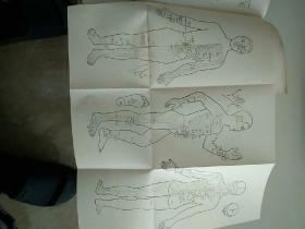 穴位压痈辨病诊断法