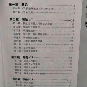 儿童CT诊断学