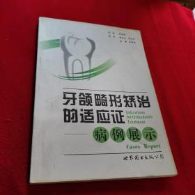 牙颌畸形矫治的适应证：病例展示