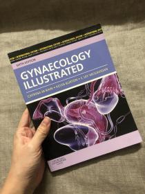 Gynaecology Illustrated, 6th Edition 插图版 妇科学 第6版【英文版，铜版纸印刷黑白插图】Gynecology