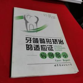 牙颌畸形矫治的适应证：病例展示