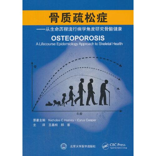 骨质疏松症——从生命历程流行病学角度研究骨骼健康