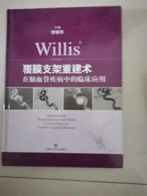 Willis覆膜支架重建术在脑血管疾病中的临床应用