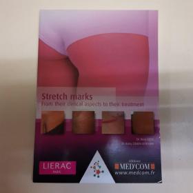 Stretch marks From their clinical aspects to their treatment(妊娠纹 从临床方面到治疗方面)