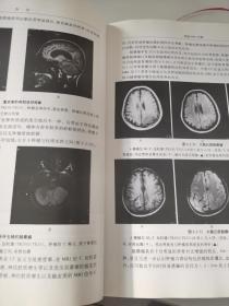 磁共振成像诊断学