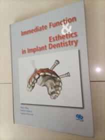 Function   Esthetics   in Implant Dentistry   
翻译结果：种植牙的功能美学