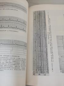 临床心电图学教程