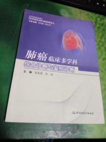 肺癌临床多学科综合诊断与鉴别诊断