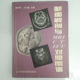 断面解剖与MRI CT ECT对照图谱