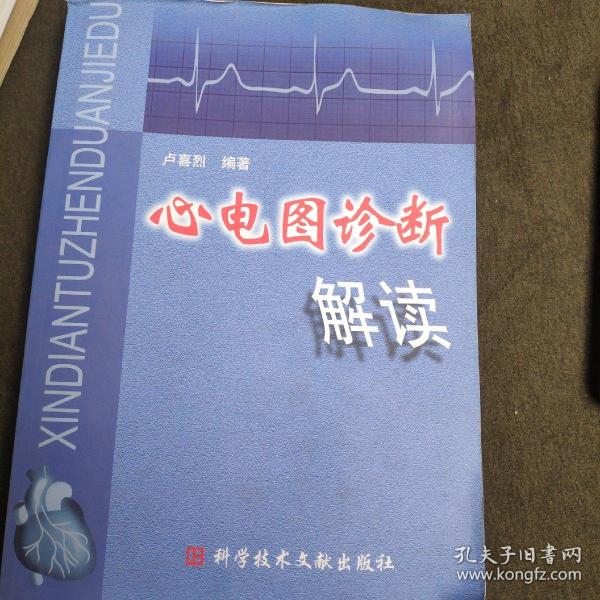 心电图诊断解读
