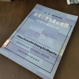 疑难心律失常心电图诊断与实例分析