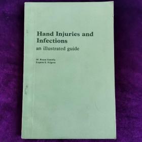 Hand Injuries and Infections an illustrated guidi