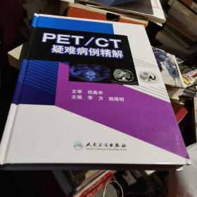 PET/CT疑难病例精解