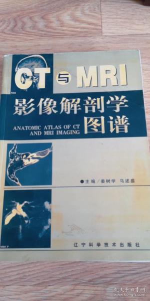 CT与MRI影像解剖学图谱