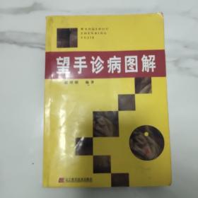 望手诊病图解