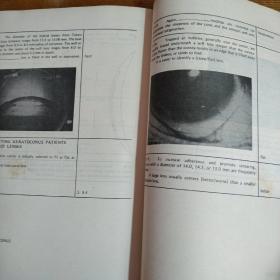 接触镜和角膜疾病【英文原版】