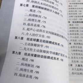 简明先天性心脏病介入治疗 广东省心血管病研究所 张智伟序