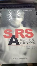 SARS临床病例及影像学分析9787506727297