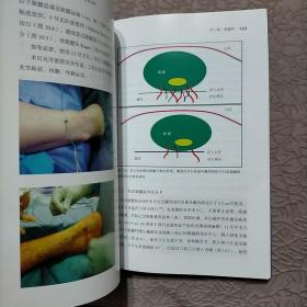 下肢肌腱病病因 生理及治疗