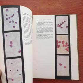 kurzer Atlas fur das klinische Laboratorium