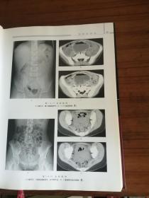 正版现货，急腹症影像学。