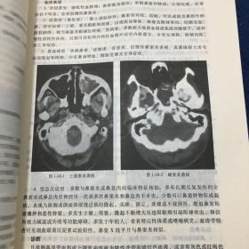 耳鼻咽喉科学实用教程