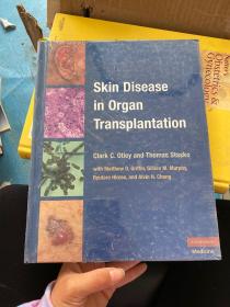 Skin Disease in Organ Transplantation[器官移植中的皮肤疾病]