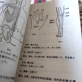 实用针灸治痛手册