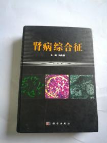 肾病综合征