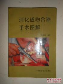 消化道吻合器手术图解