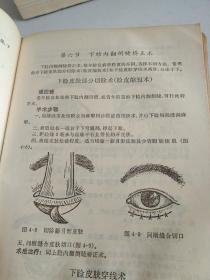 常见病手术治疗手册