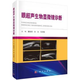 眼超声生物显微镜诊断