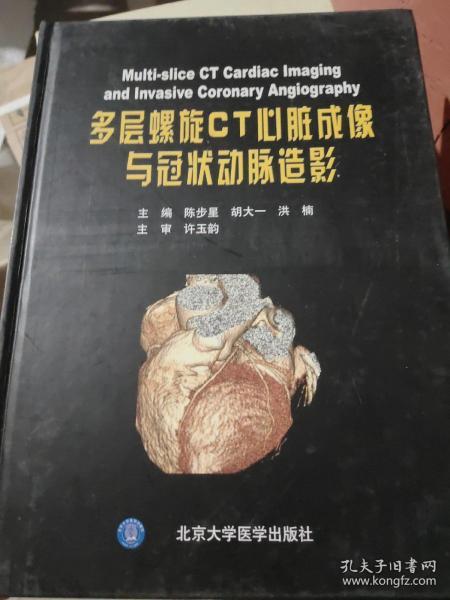 多层螺旋CT心脏成像与冠状动脉造影