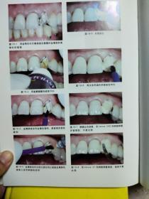 树脂修复经典案例【精装·2009年一版一印】八14-4