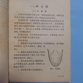 几种中医简易诊断法 本书收载十九种病、四十六种诊断方法 1964年1版1印