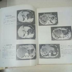 腹部CT图谱