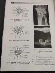 腕关节外科学：高级理论与手术技巧