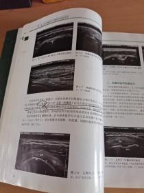 肌骨关节系统超声检查规范（有5，6页轻微划线见图）