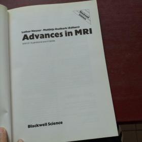 Advances in MRI