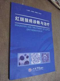 红斑狼疮诊断与治疗
