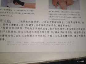实用推拿疗法挂图