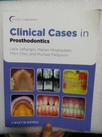 现货 Clinical Cases in Prosthodontics  (Clinical Cases (Dentistry)) 英文原版 口腔修复学 修复临床病例解析 牙科学 Jahangiri 全口义齿临床修复 口腔医学