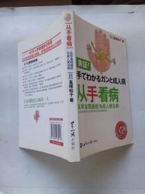 从手看病:及早发现癌症与成年人常见病（2009年一版一印）