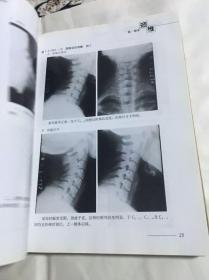 骨伤科影像读片解析-颈腰椎疾病