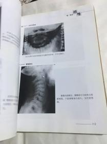 骨伤科影像读片解析-颈腰椎疾病