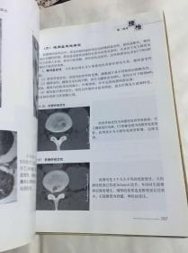 骨伤科影像读片解析-颈腰椎疾病