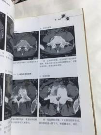 骨伤科影像读片解析-颈腰椎疾病